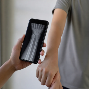 App Raio X Celular: Como Funciona a Simulação
